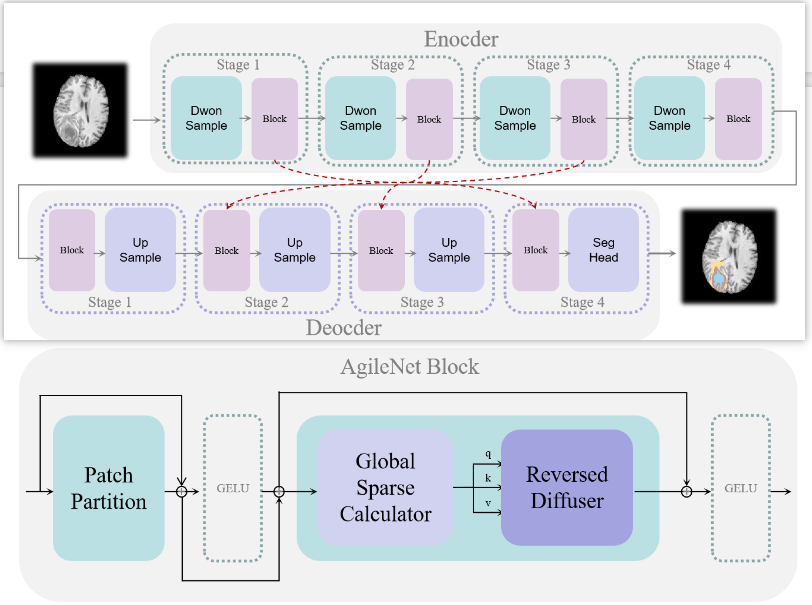 AgileNet: A Rapid and Efficient Breast Lesion Segmentation Method for Medical Image Analysis