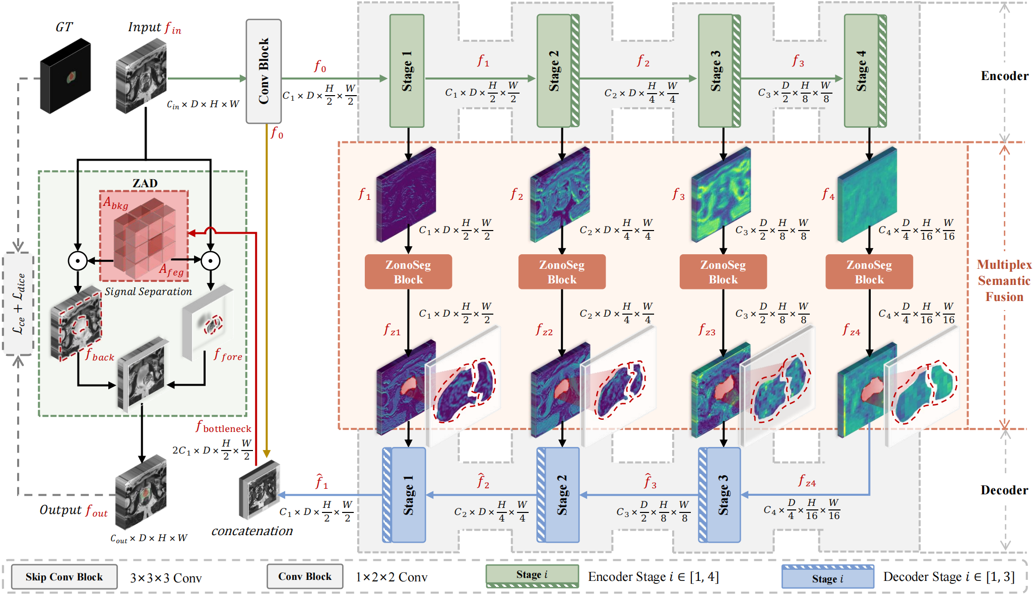 ZonoSeg: A Zonal-aware Prostate Segmentation Framework on 3D MRI Images
